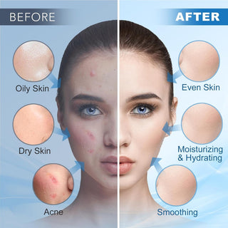 Jelly Mask Powder for Facials, Hydrating & Moisturizing Jelly Face Mask Skin Care Hyalorunic Acid