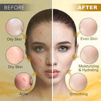 Jelly Mask Powder for Facials, Hydrating & Moisturizing Jelly Face Mask Skin Care Luxury 24K Gold