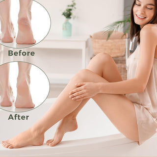 Hard Skin Removal Feet - Stainless Steel Foot File for Dead Skin Remover, Professional Callus Remover for Wet And Dry Feet,Gray