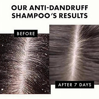 Clear Sakura Fresh Anti-dandruff Shampoo 330ml